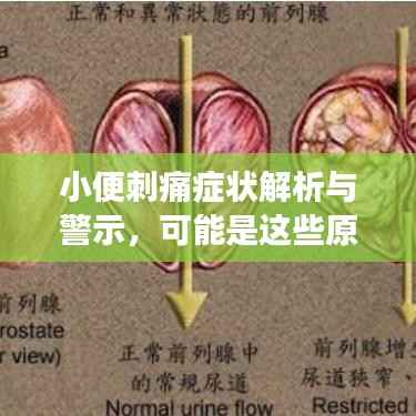 小便刺痛症状解析与警示,可能是这些原因导致的,健康不容忽视!